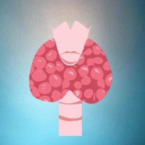 Thyroid Test in Hyderabad | T3, T4, TSH | Aadhunika Lab
