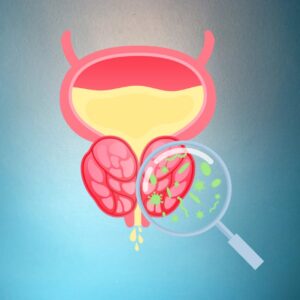 PSA Test in Hyderabad | Prostate Health Screening