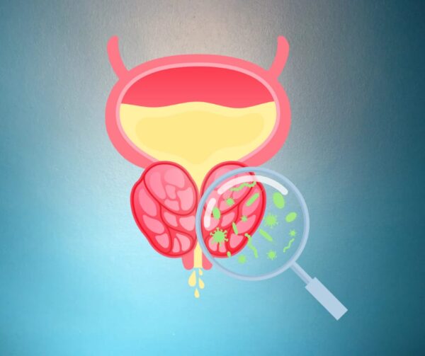 PSA Test in Hyderabad | Prostate Health Screening