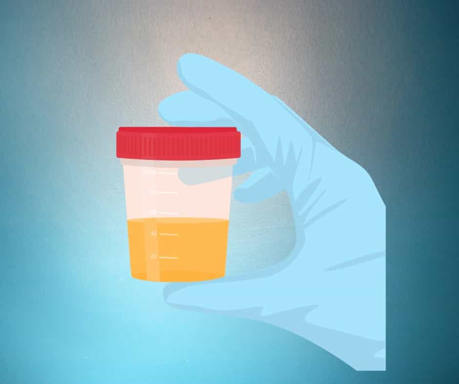 complete urine examination (cue)